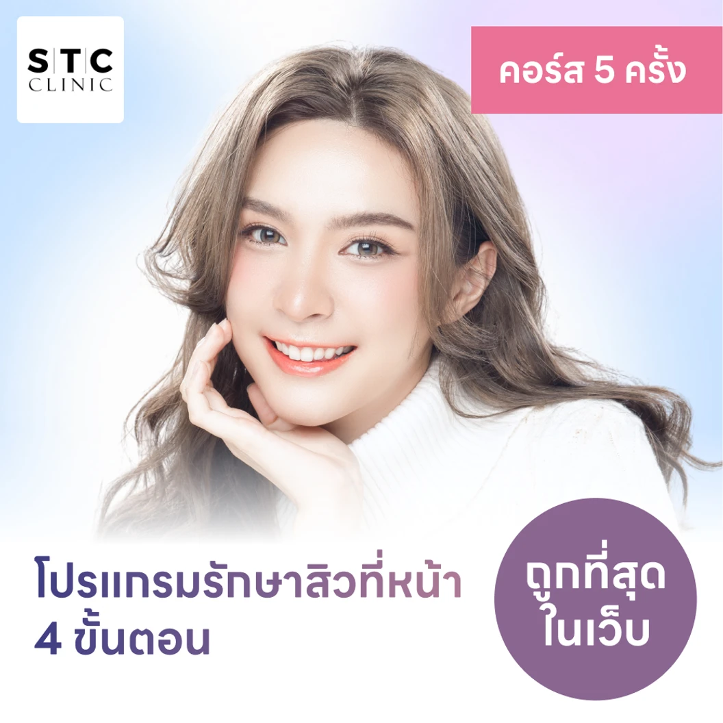 คอร์สโปรแกรมรักษาสิวทั่วใบหน้า 4 ขั้นตอน จำนวน 4 ครั้ง ฟรี! 1 ครั้ง แพ็กเกจHDmall+ ที่ STC Anti-Aging & Wellness Clinic