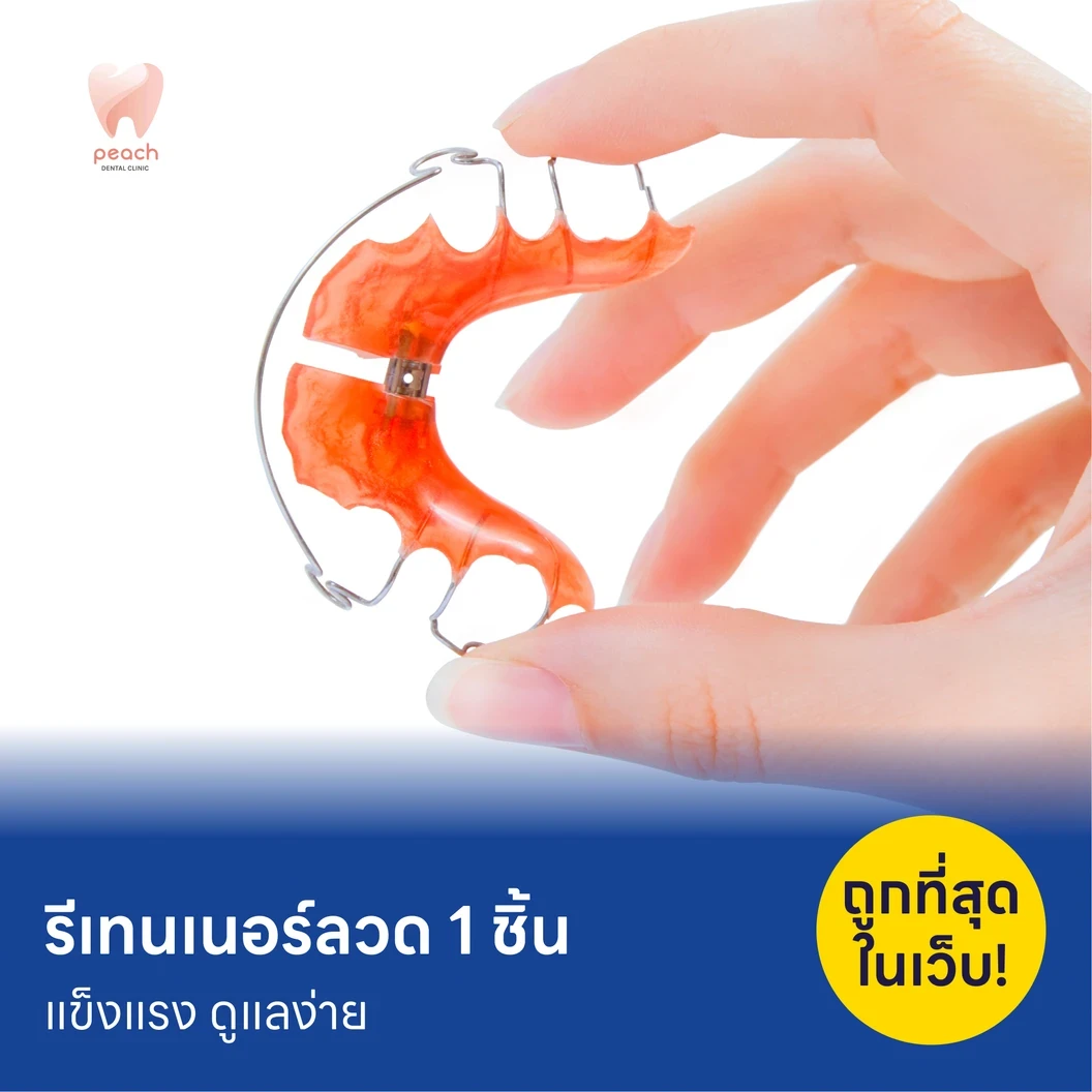 ทำรีเทนเนอร์แบบลวด 1 ชิ้น แพ็กเกจ HDmall+ ที่ Peach Dental Clinic