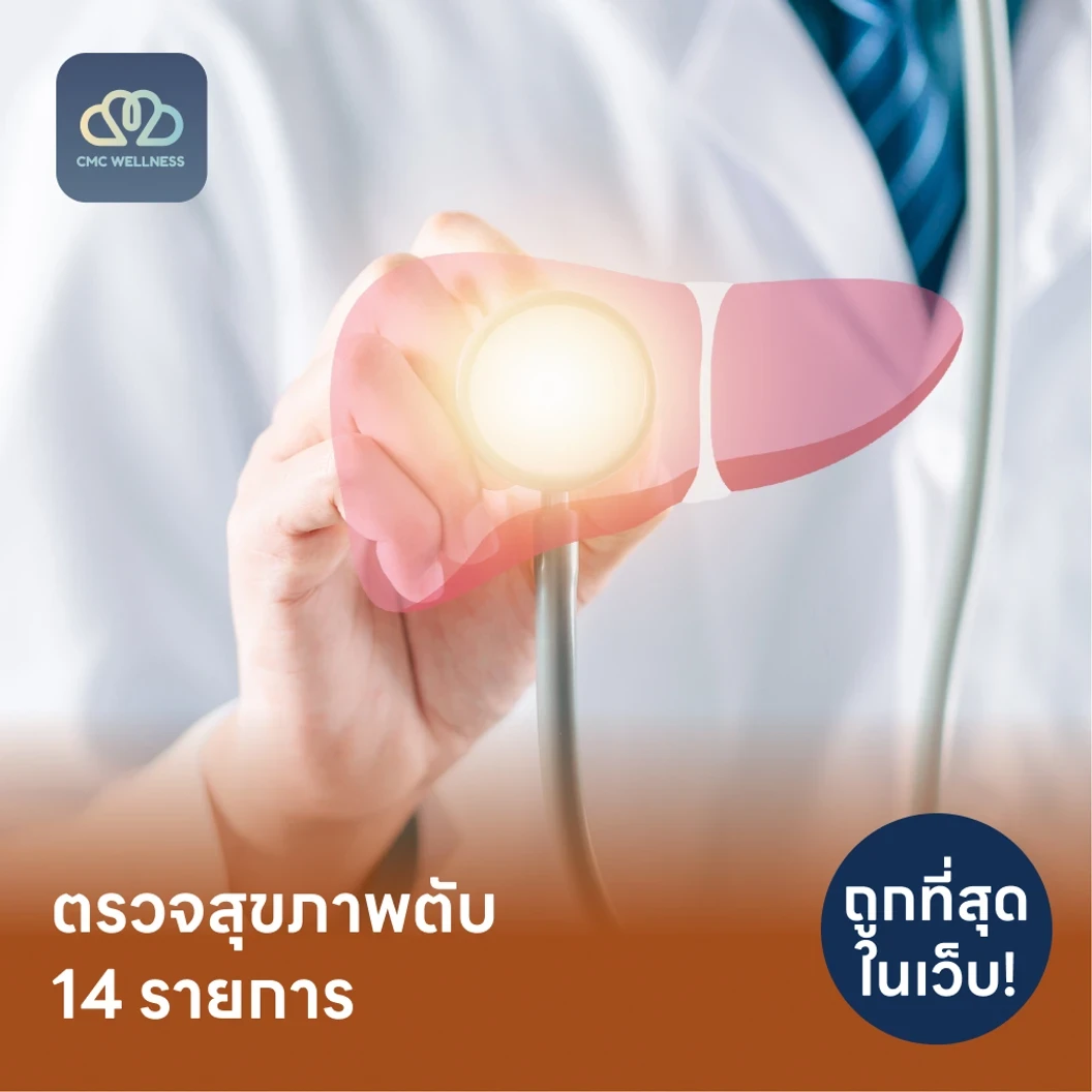 ตรวจสุขภาพตับ 14 รายการ รวมตรวจหาสารบ่งชี้มะเร็งตับ และตรวจหาภูมิคุ้มกันไวรัสตับอักเสบ แพ็กเกจ HDmall+ ที่ CMC Wellness