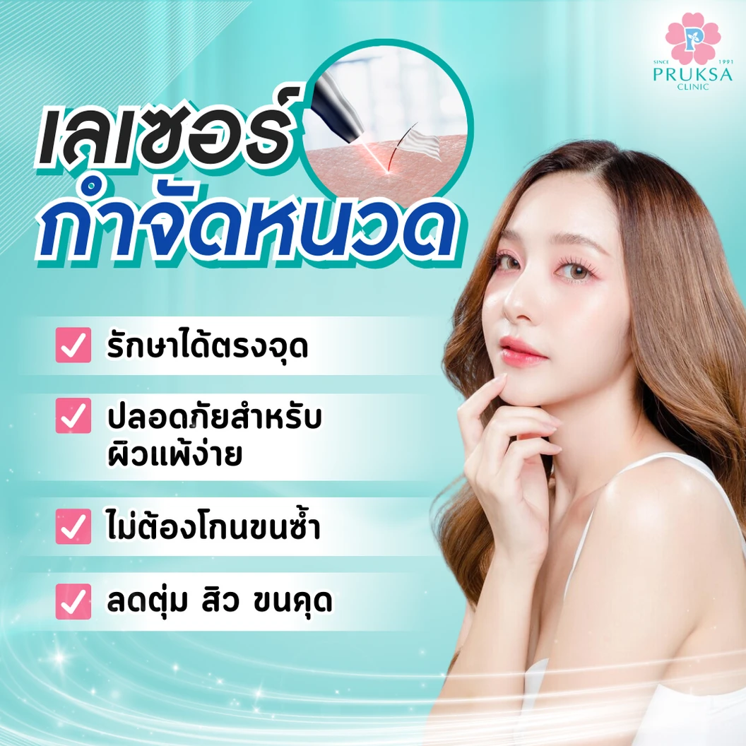 กำจัดขนหนวดด้วย Diode Laser 1 ครั้ง ที่ พฤกษาคลินิก Pruksa Clinic