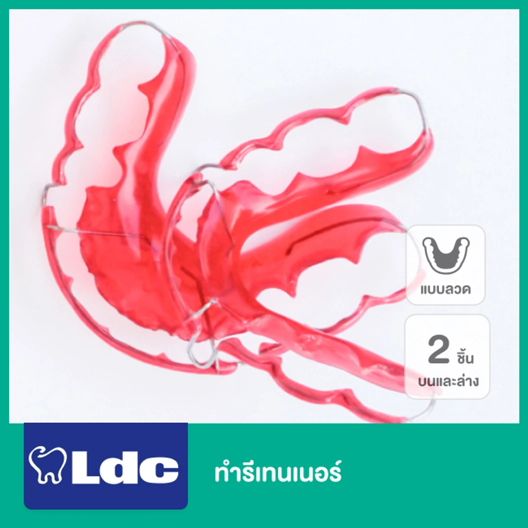 ทำรีเทนเนอร์แบบลวด 2 ชิ้น บนและล่าง ที่ LDC Dental