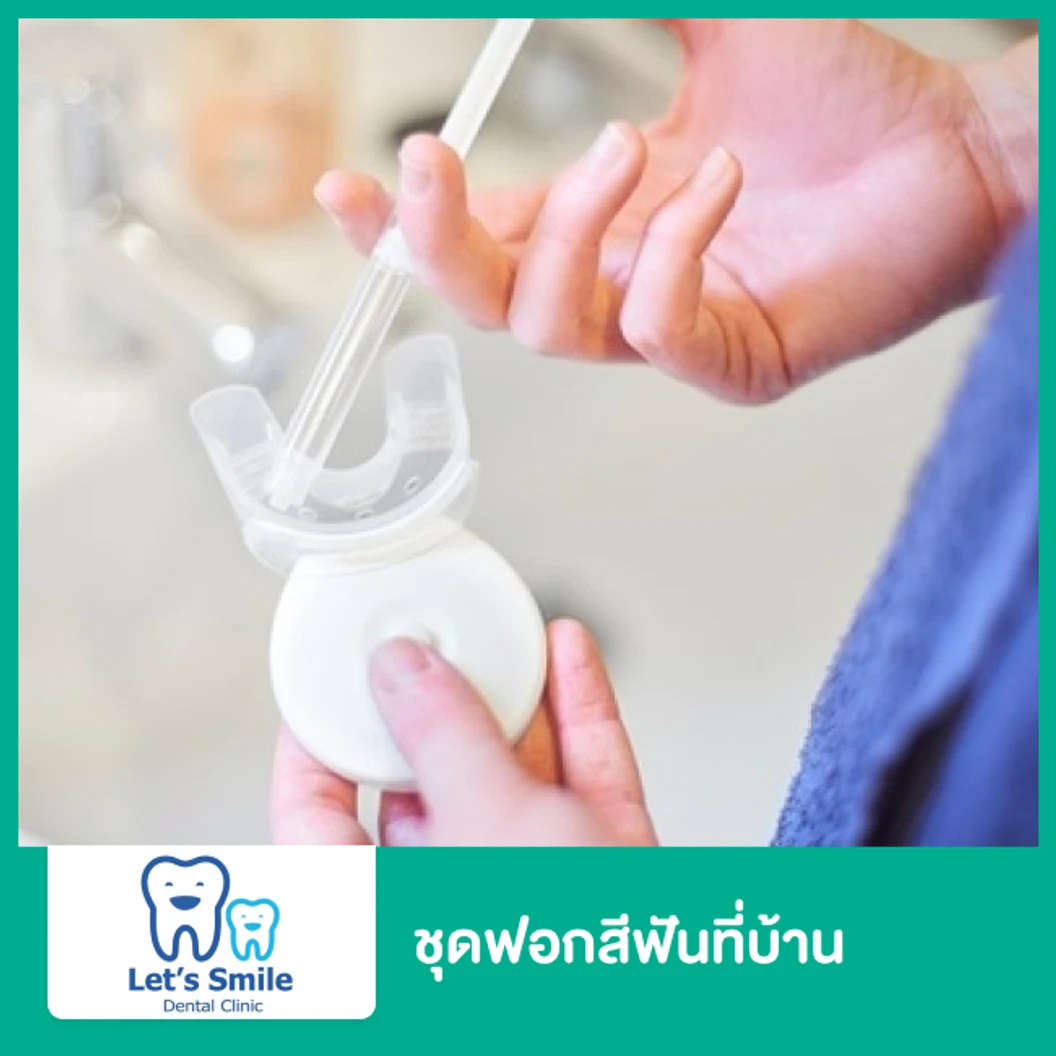 ชุดฟอกสีฟันที่บ้าน  ที่ Lets Smile Dental Clinic