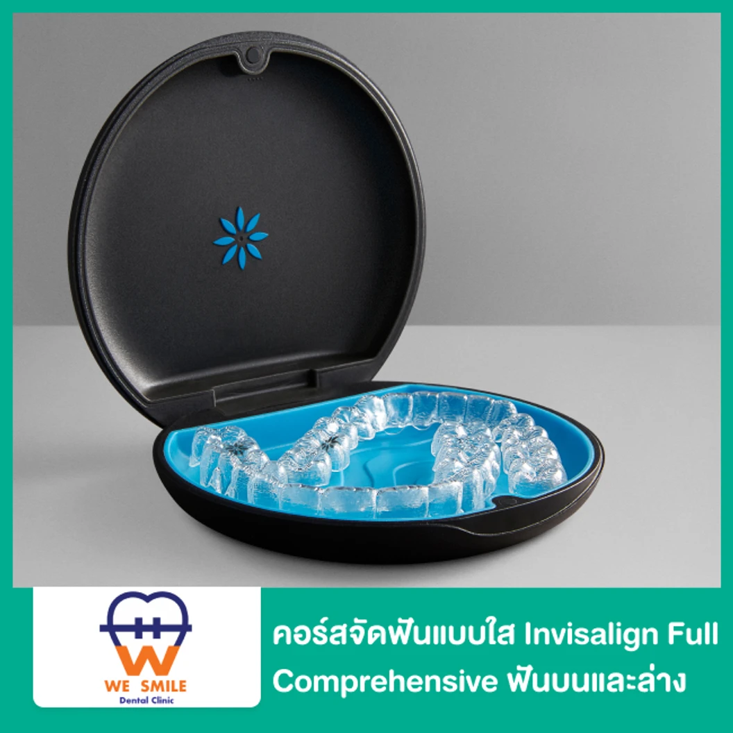 คอร์สจัดฟันแบบใส Invisalign Full Comprehensive ฟันบนและล่าง ที่ We Smile Dental Clinic