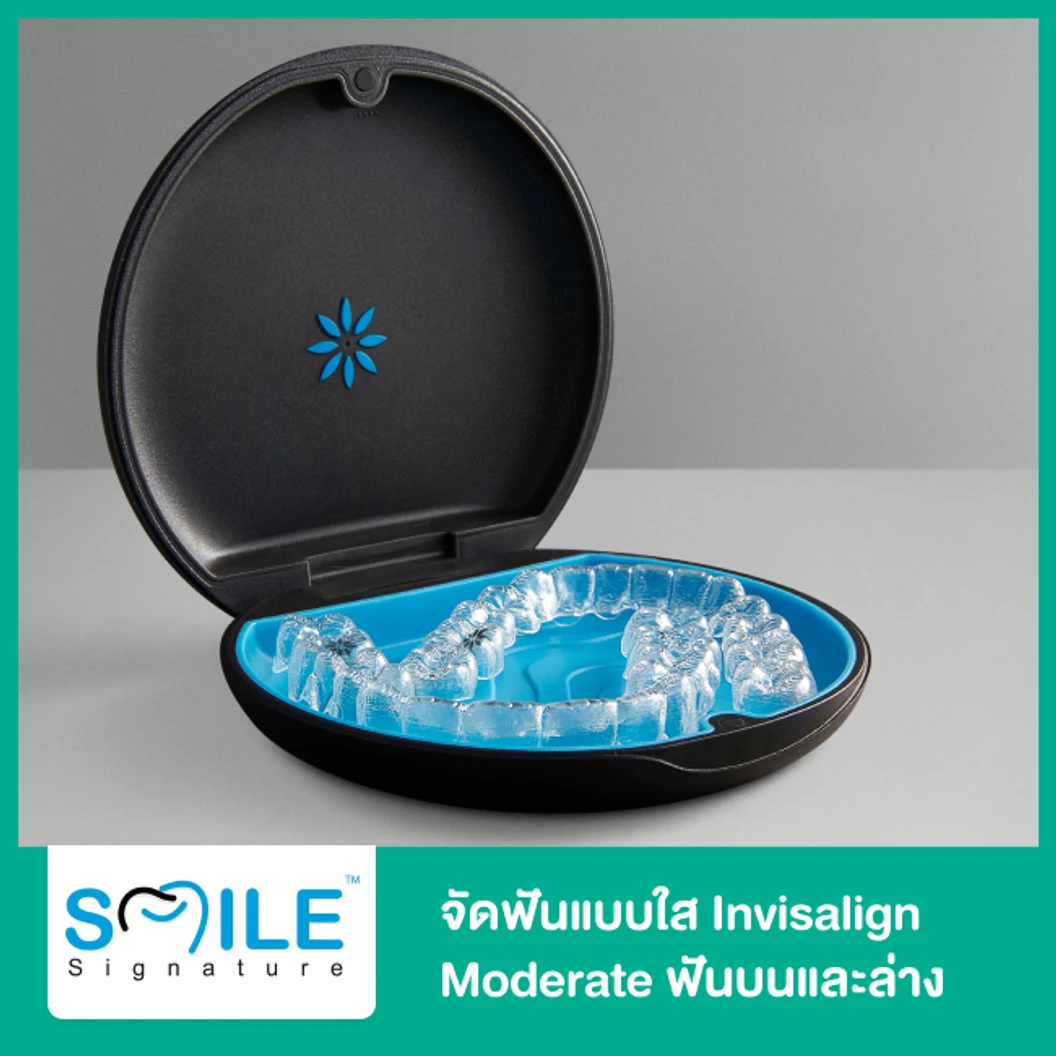 จัดฟันแบบใส Invisalign Moderate ฟันบนและล่าง ที่ Smile Signature คลินิกทันตกรรมสไมล์ ซิกเนเจอร์