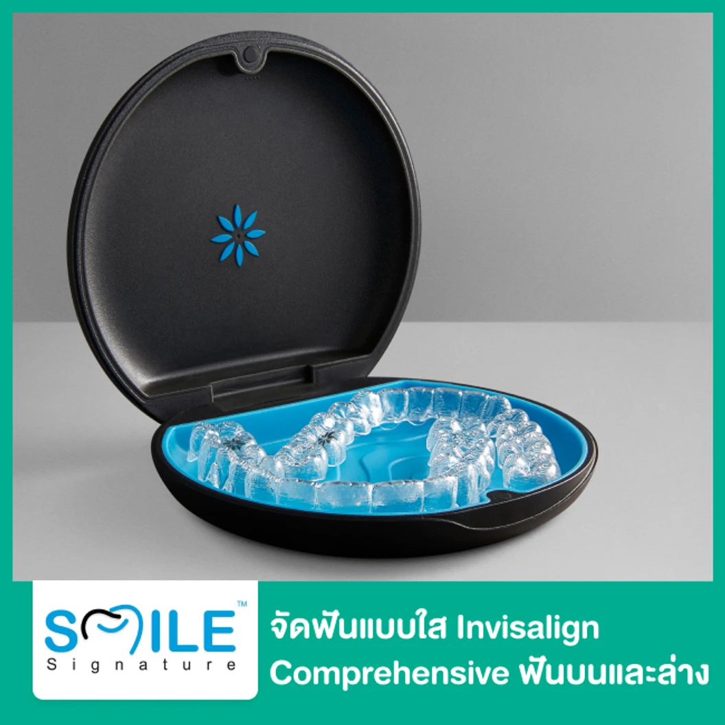 จัดฟันแบบใส Invisalign Comprehensive ฟันบนและล่าง ที่ Smile Signature คลินิกทันตกรรมสไมล์ ซิกเนเจอร์