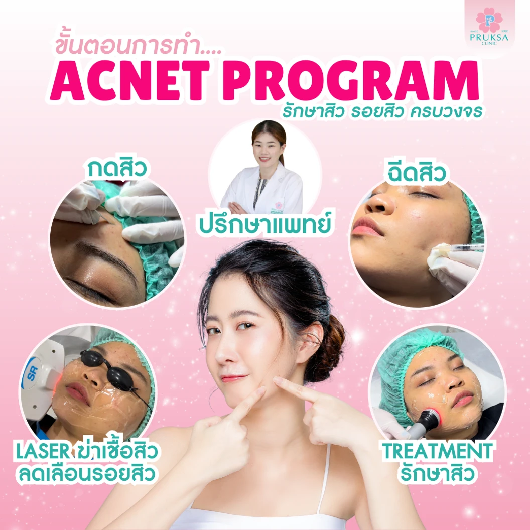 รักษาสิว พร้อมเลเซอร์เพื่อผิวกระจ่างใส Acnet Program 1 ครั้ง ที่ พฤกษาคลินิก Pruksa Clinic
