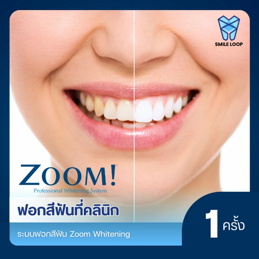ฟอกสีฟันที่คลินิก ด้วยระบบ Zoom ที่ SMILE LOOP dental clinic คลินิกทันตกรรมสไมล์ลูป