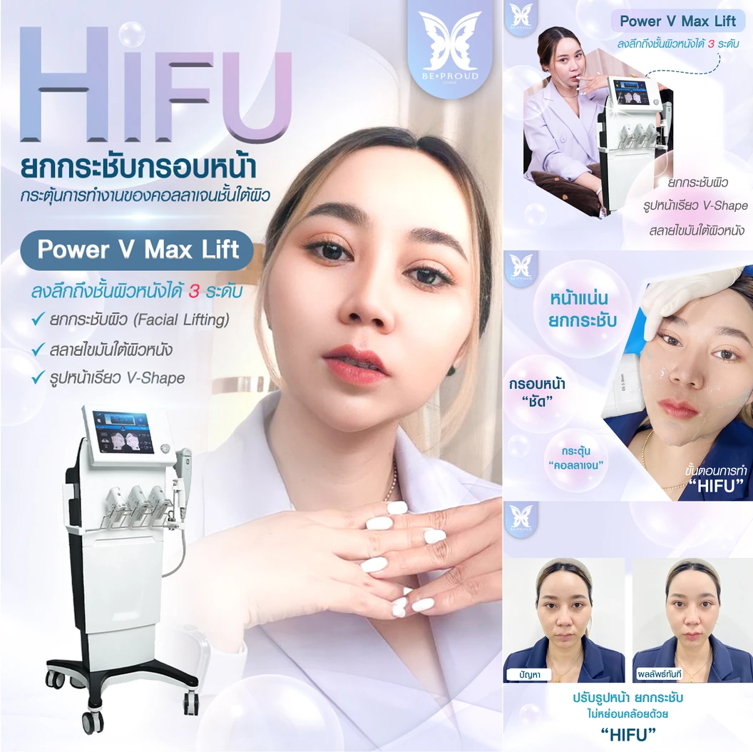 ทำ HIFU จำนวนช็อตขึ้นอยู่กับแพทย์ประเมิน บริเวณทั่วใบหน้า 1 ครั้ง ที่ Beproud Clinic
