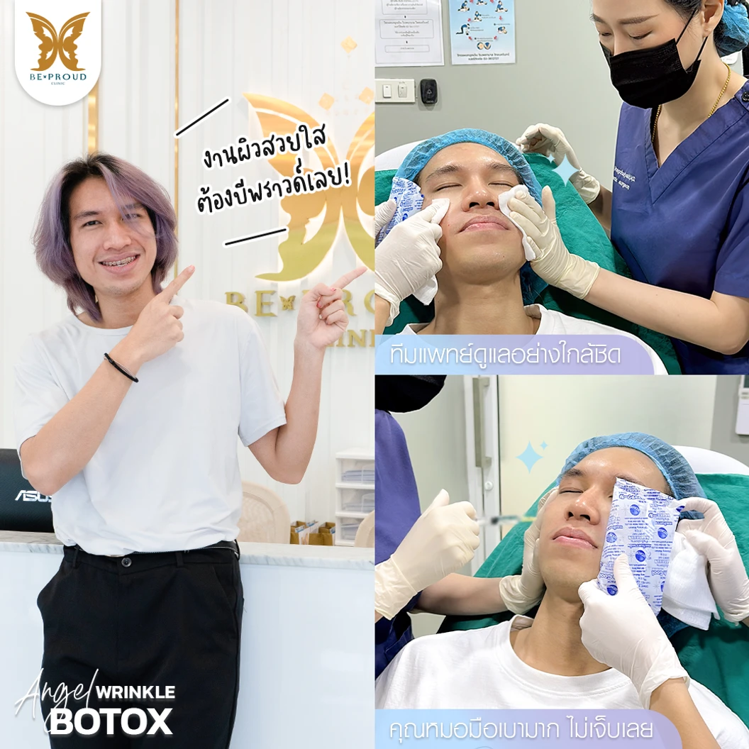 โปรแกรมโบท็อกซ์ 100 ยูนิต บริเวณที่มีปัญหา ที่ Beproud Clinic