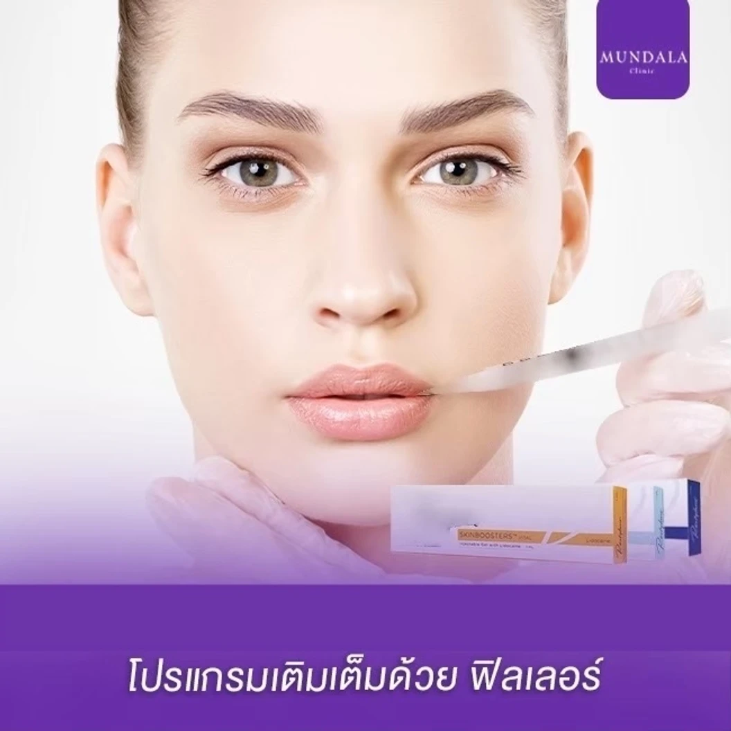 โปรแกรมฟิลเลอร์ 1 ซีซี หน้า ที่ Mundala Clinic