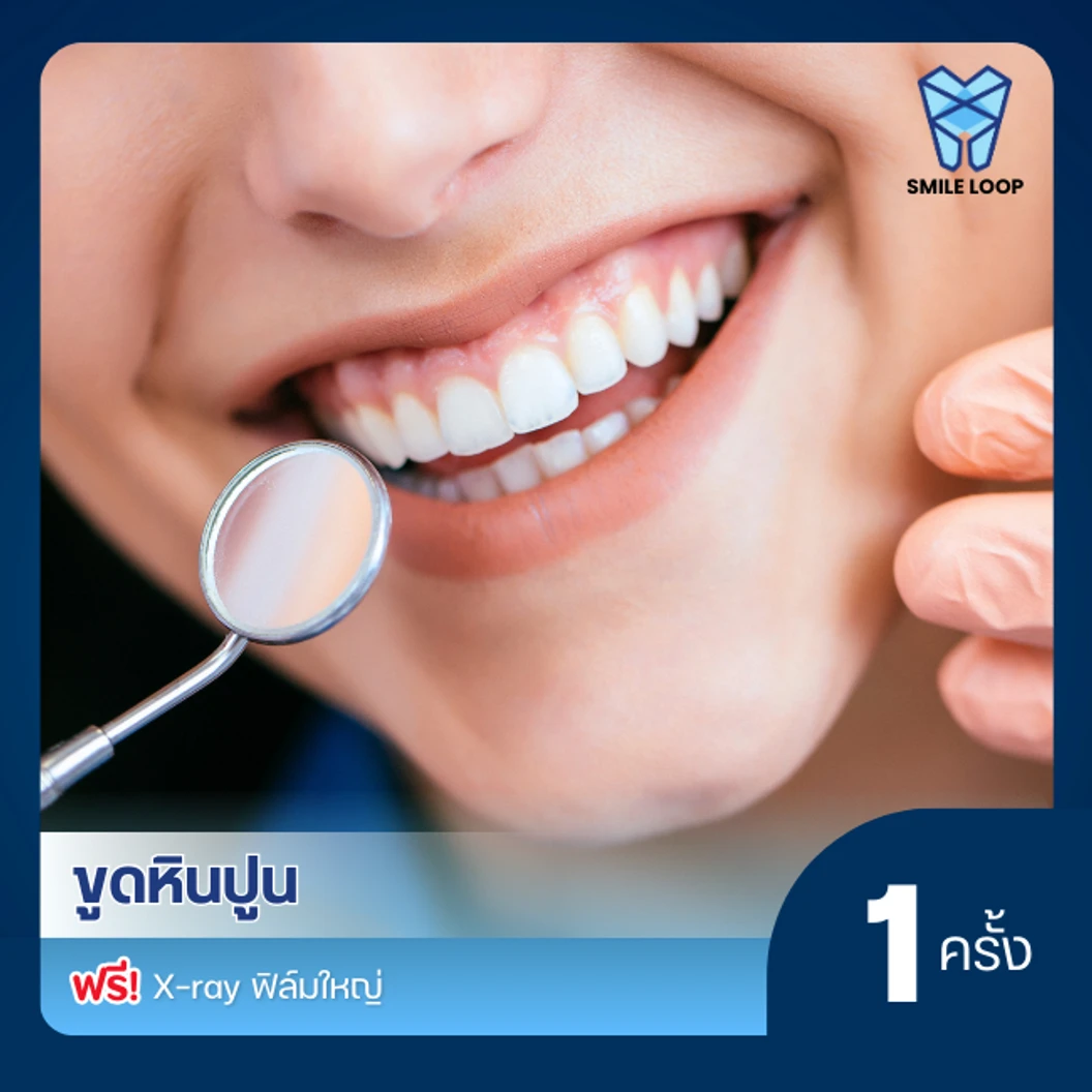 ขูดหินปูน ฟรี! X-ray ฟิล์มใหญ่ ที่ SMILE LOOP dental clinic คลินิกทันตกรรมสไมล์ลูป