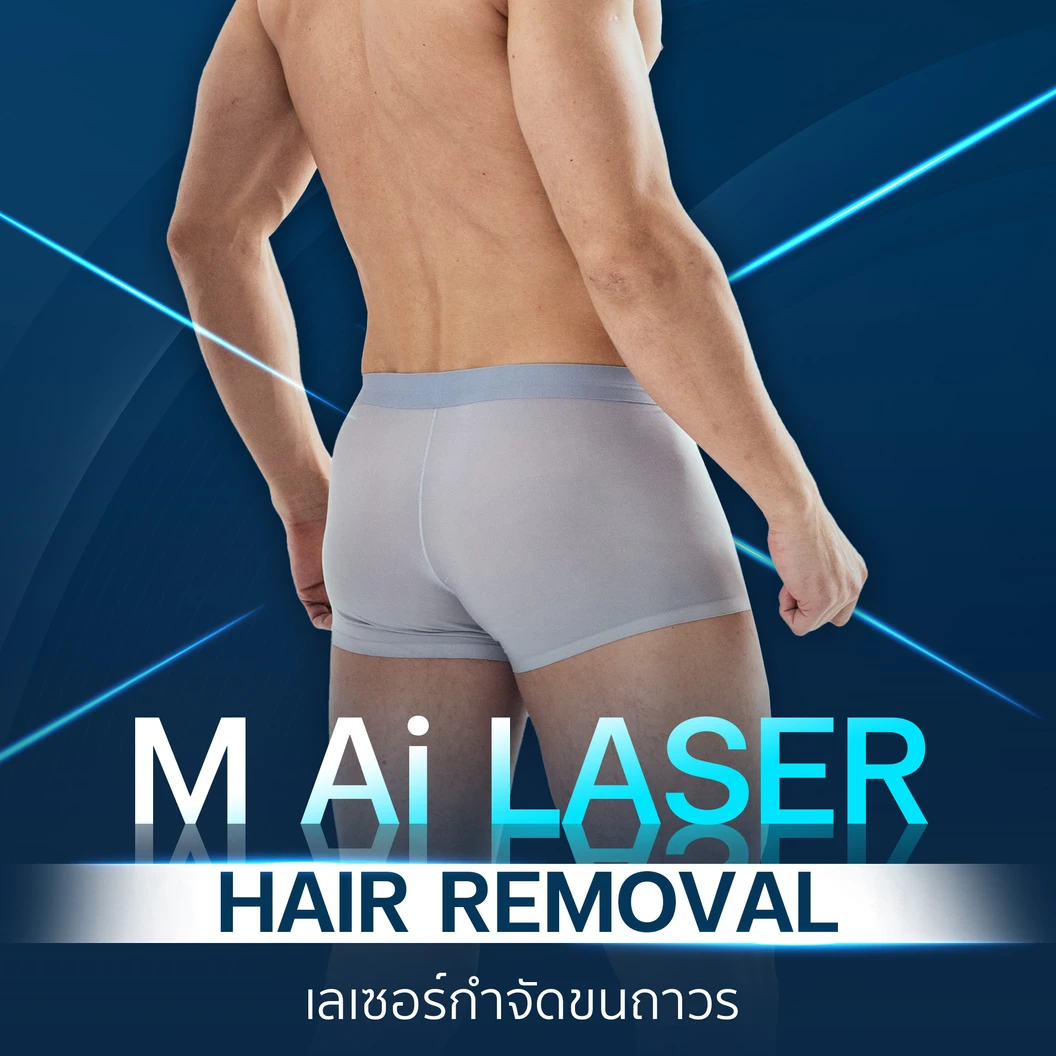 กำจัดขน Bikini ด้วย Ai Laser 1 ครั้ง สำหรับผู้ชายเท่านั้น ที่ M Clinic