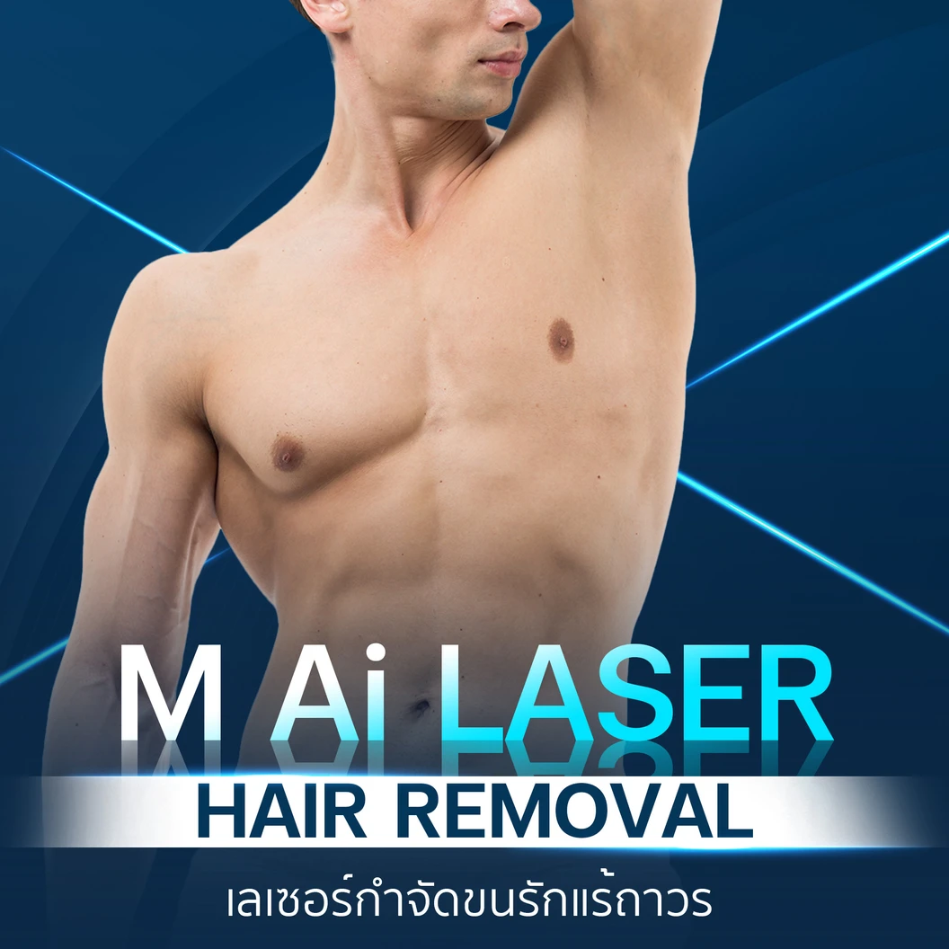 เลเซอร์ AI กำจัดขนรักแร้ 1 ครั้ง ผู้ชายเท่านั้น ที่ M Clinic