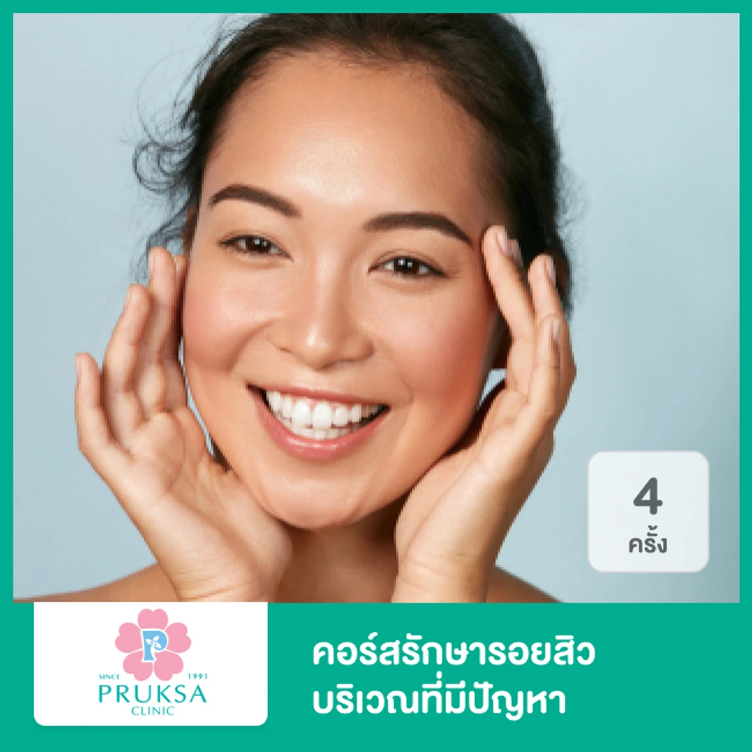 คอร์สรักษารอยสิว บริเวณที่มีปัญหา Junior Acne Scar Program 4 ครั้ง ที่ พฤกษาคลินิก Pruksa Clinic