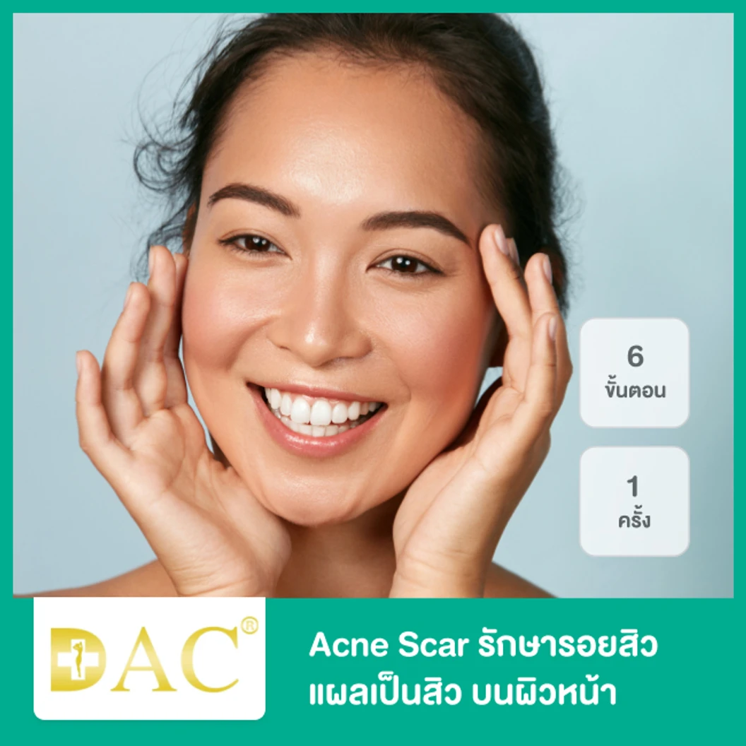 Acne Scar รักษารอยสิว แผลเป็นสิว บนผิวหน้า 6 ขั้นตอน 1 ครั้ง ที่ DAC Clinic