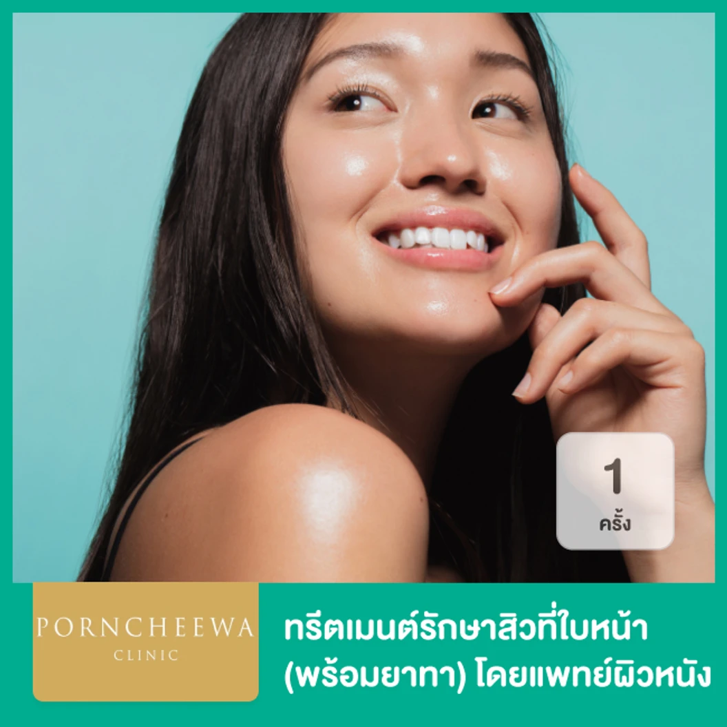 ทรีตเมนต์รักษาสิวที่ใบหน้า พร้อมยาทา โดยแพทย์ผิวหนัง 1 ครั้ง ที่ Porncheewa Clinic