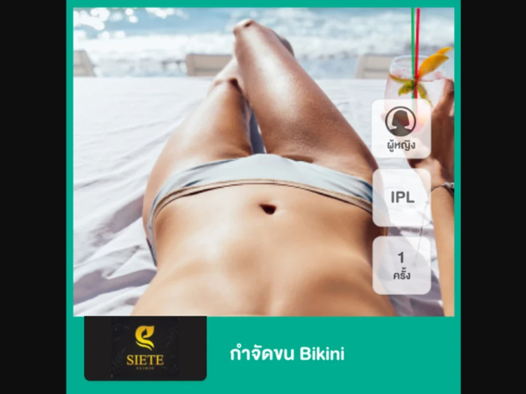 กำจัดขน Bikini ด้วย IPL 1 ครั้ง สำหรับผู้หญิงเท่านั้น ที่ Siete Clinic