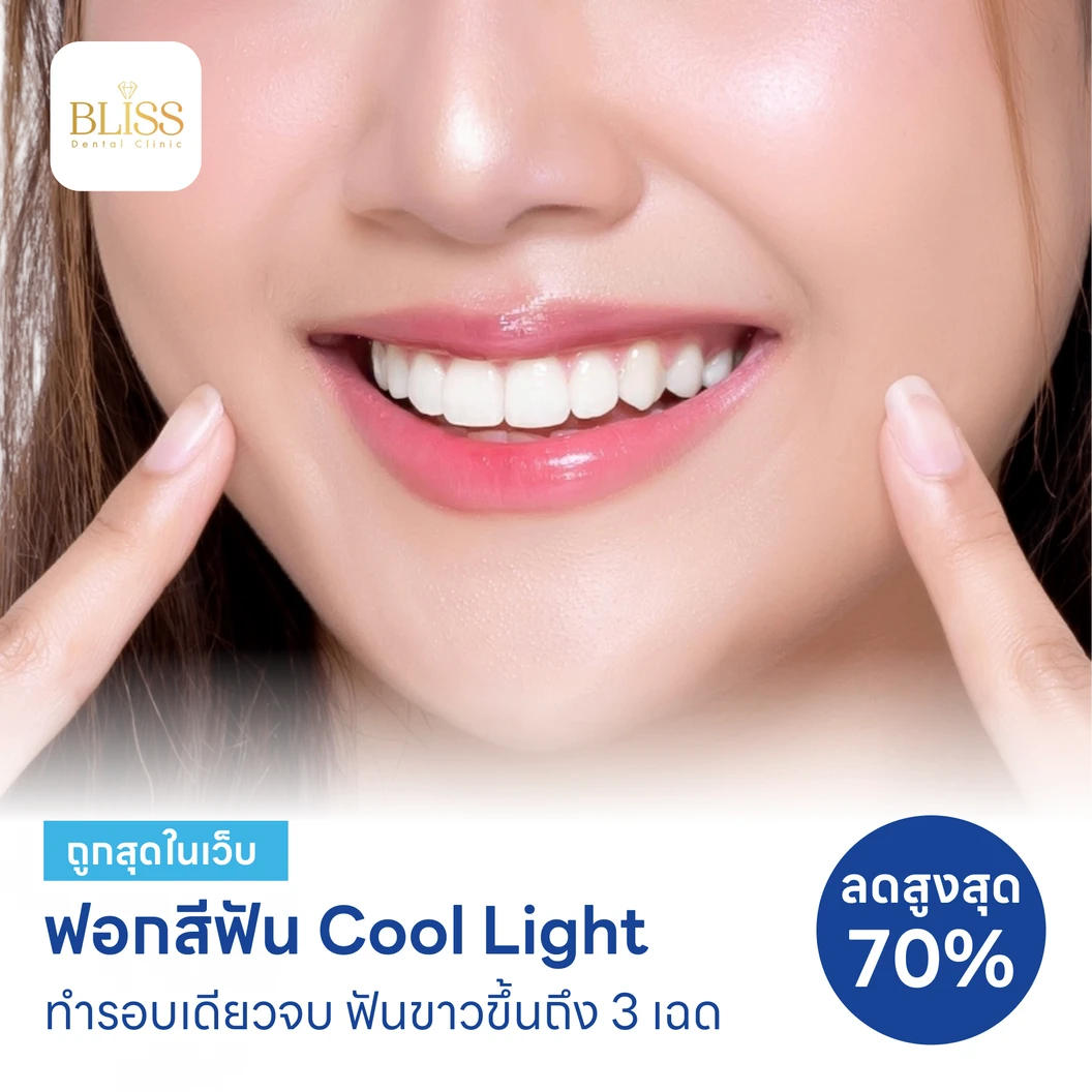 ฟอกสีฟันที่คลินิก ด้วยระบบ Cool Light แพ็กเกจ HDmall+ ที่ Bliss Dental Clinic