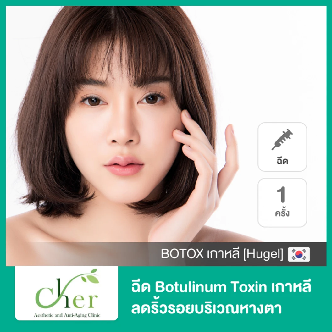โปรแกรมโบท็อกซ์ จำนวนยูนิตขึ้นอยู่กับแพทย์ประเมิน ลดริ้วรอยหางตา ที่ Cher Clinic