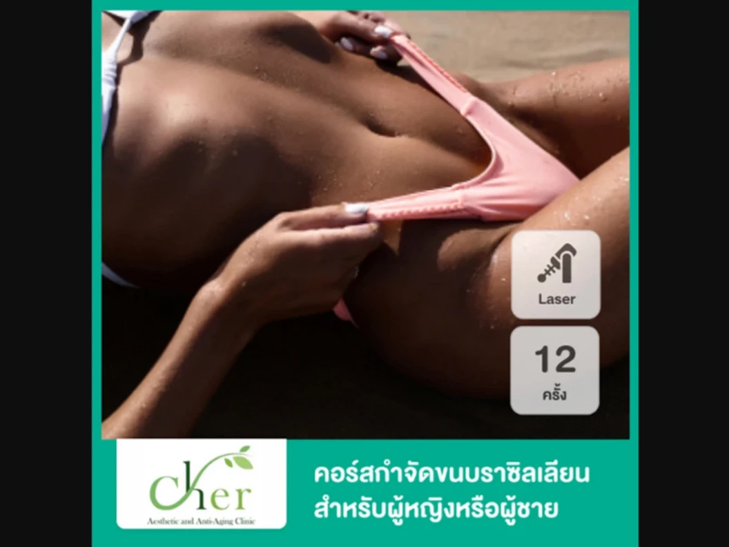 คอร์สกำจัดขน Brazilian ด้วย Diode Laser 12 ครั้ง ภายใน 1 ปี สำหรับผู้ชายเท่านั้น ที่ Cher Clinic