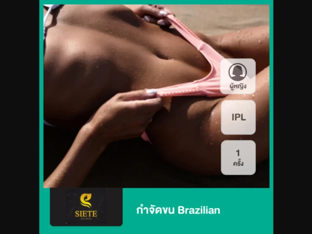 กำจัดขน Brazilian ด้วย IPL 1 ครั้ง สำหรับผู้หญิงเท่านั้น ที่ Siete Clinic