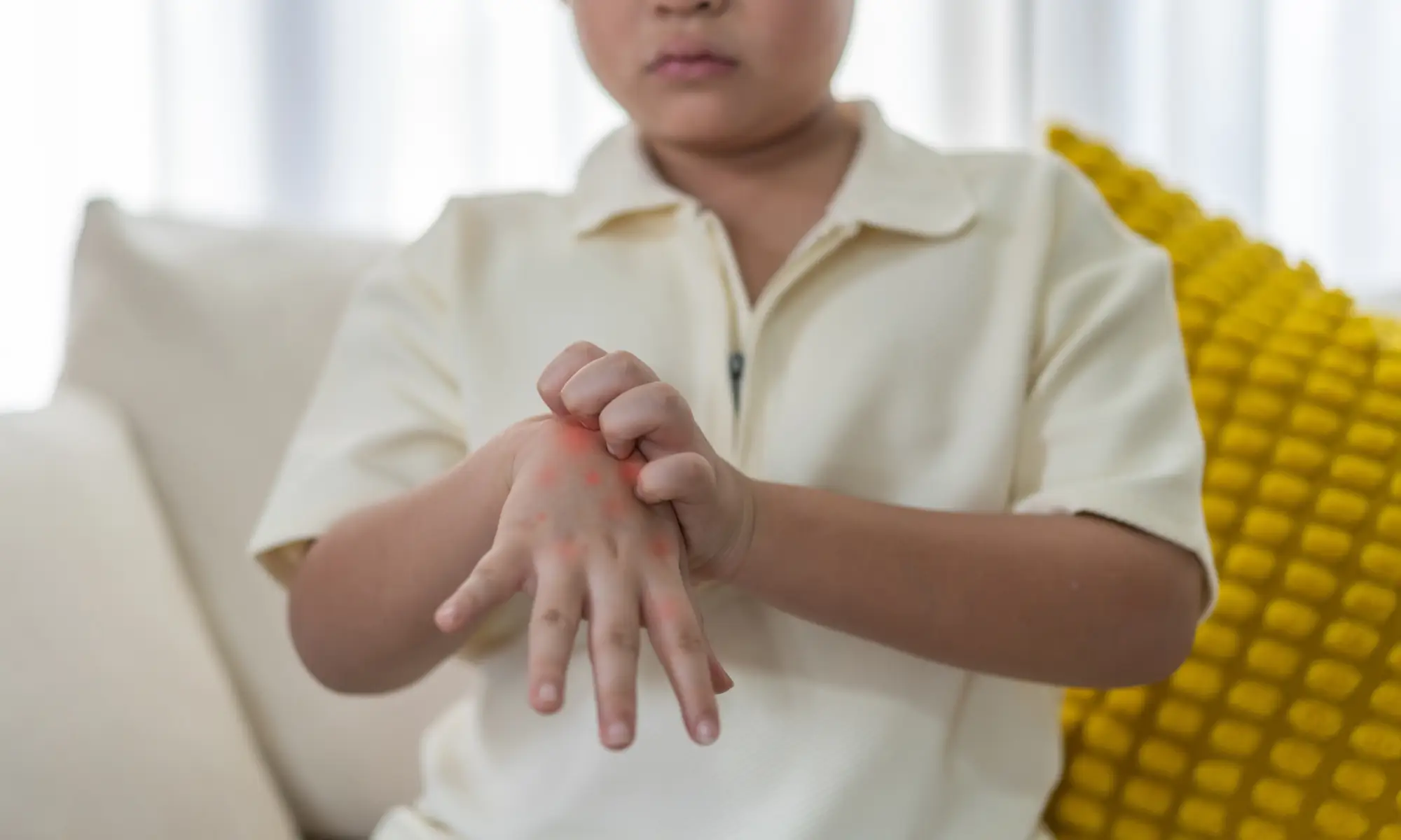 can hfmd recurrent disease definition