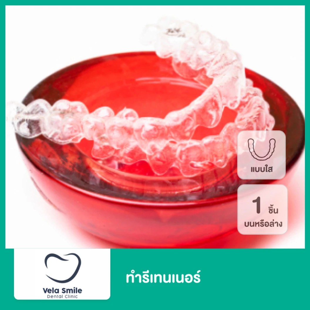 ทำรีเทนเนอร์แบบใส 1 ชิ้น ฟันบนหรือล่าง ที่ Vela Smilee Dental Clinic