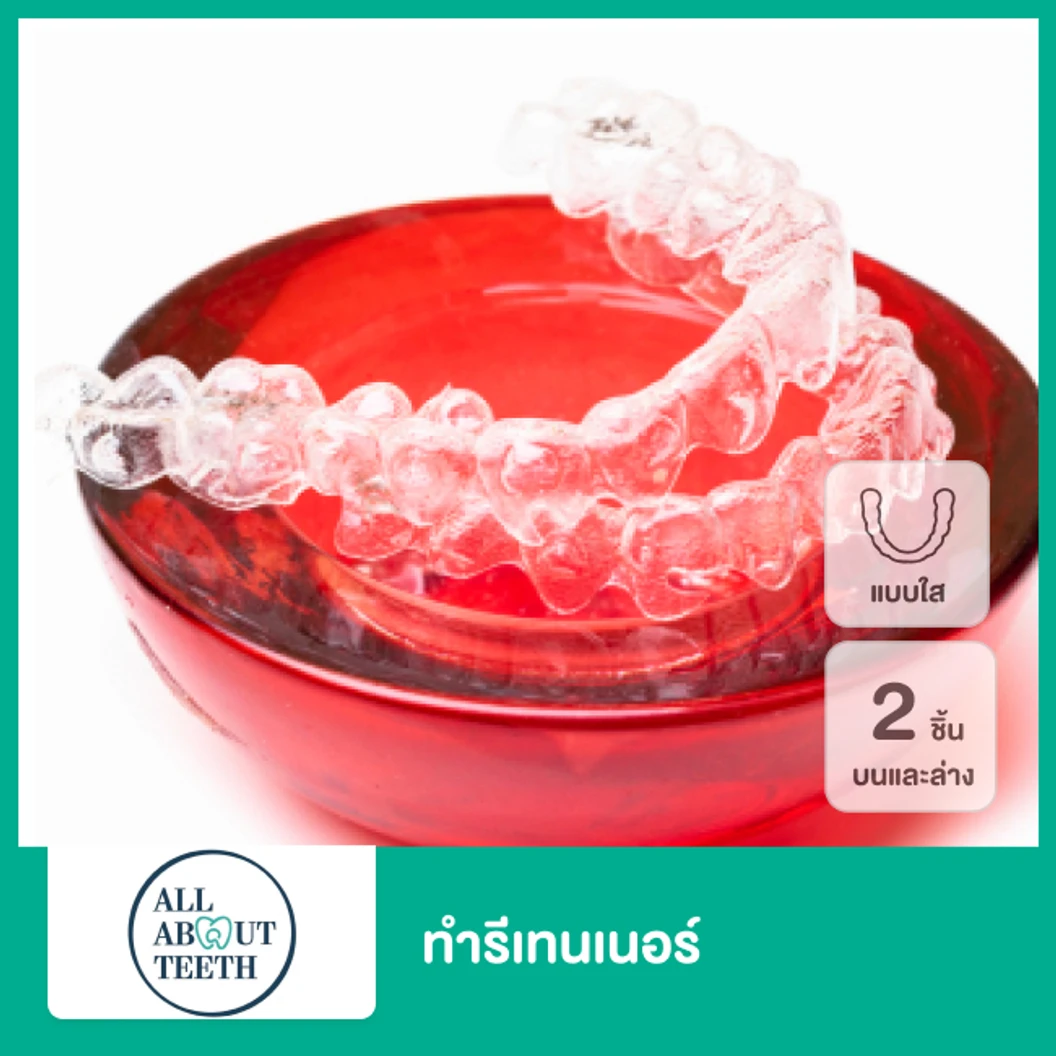 ทำรีเทนเนอร์แบบใส 2 ชิ้น ฟันบนและล่าง ที่ All About Teeth Clinic