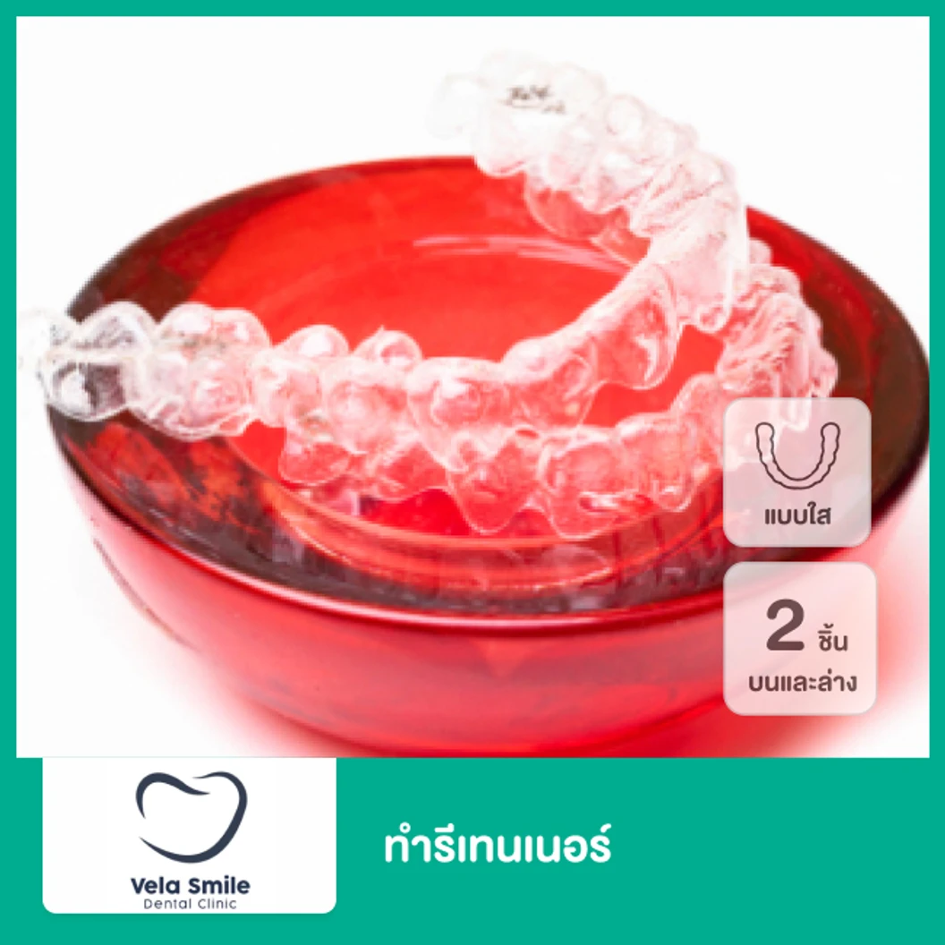 ทำรีเทนเนอร์แบบใส 2 ชิ้น ฟันบนและล่าง ที่ Vela Smilee Dental Clinic