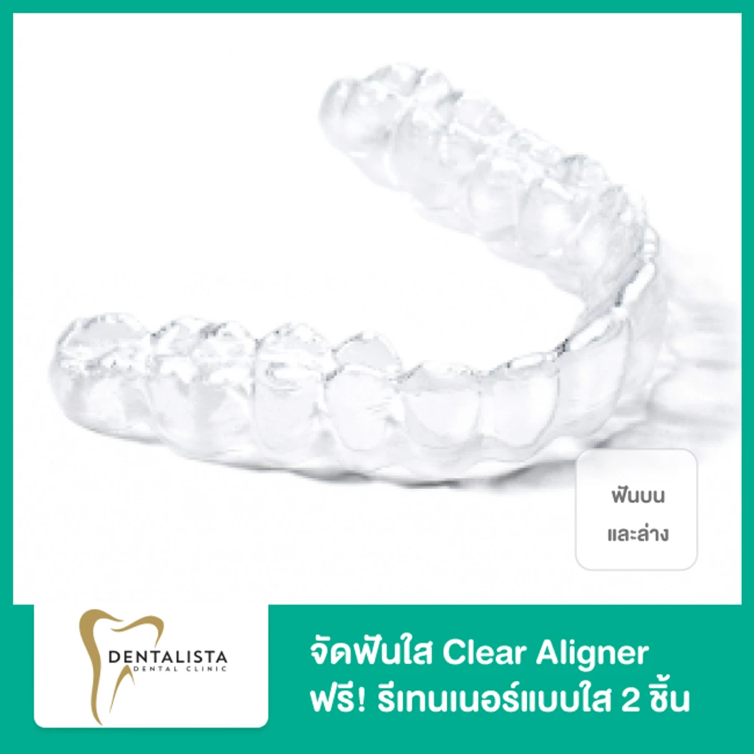 จัดฟันใส Clear Aligner 1 เซ็ต ฟันบนและล่าง ฟรี! รีเทนเนอร์แบบใส 2 ชิ้น ฟันบนและล่าง ที่ Dentalista Clinic