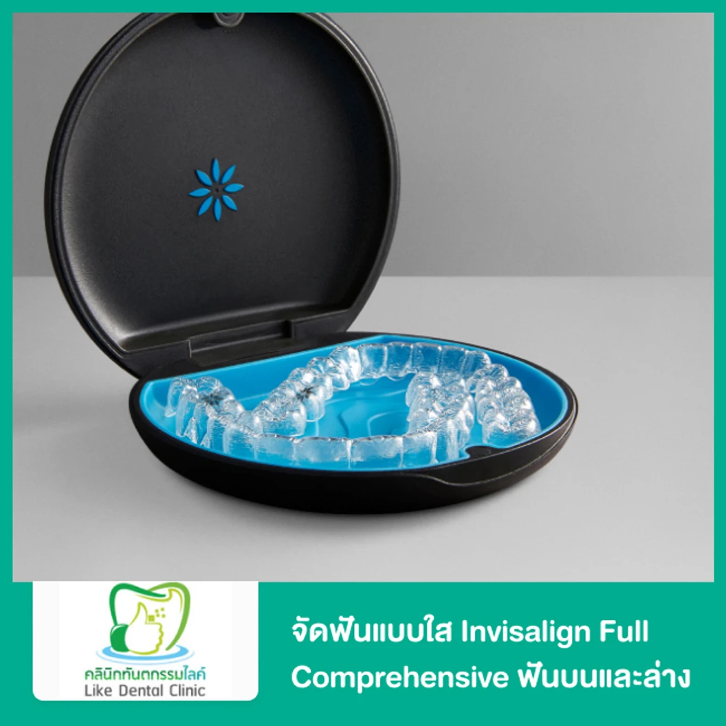 จัดฟันใส Invisalign Full Comprehensive ฟันบนและล่าง ที่ Like Dental Clinic