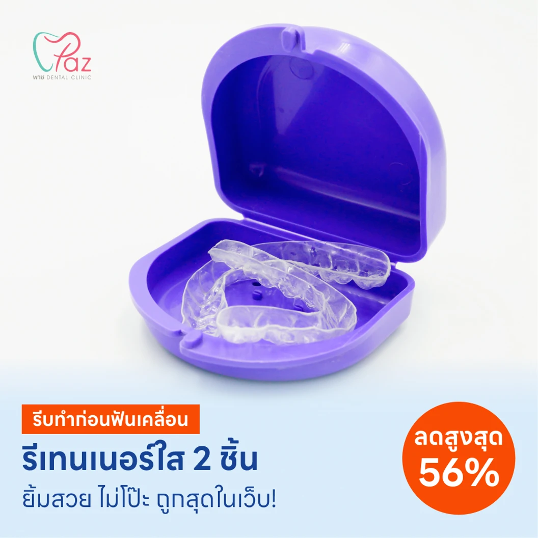 ทำรีเทนเนอร์แบบใส 2 ชิ้น แพ็กเกจ HDmall+ ที่ Paz dental Clinic
