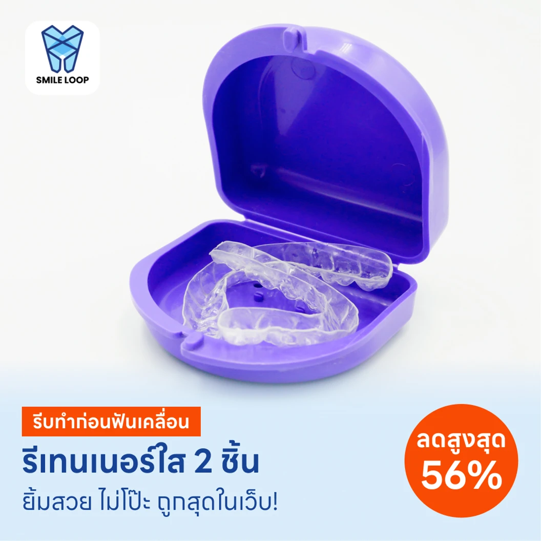 ทำรีเทนเนอร์แบบใส 2 ชิ้น แพ็กเกจ HDmall+ ที่ SMILE LOOP dental clinic คลินิกทันตกรรมสไมล์ลูป