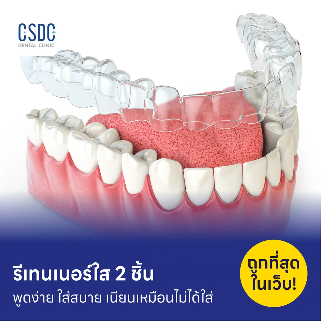 ทำรีเทนเนอร์แบบใส 2 ชิ้น ฟันบนและล่าง แพ็กเกจ HDmall+ ที่ CSDC