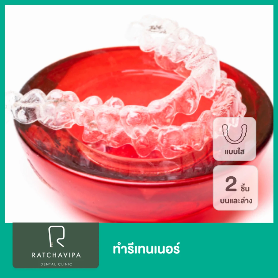 ทำรีเทนเนอร์แบบใส 2 ชิ้น ฟันบนและล่าง ที่ Ratchavipa Dental Clinic คลินิกทันตกรรมรัชวิภา