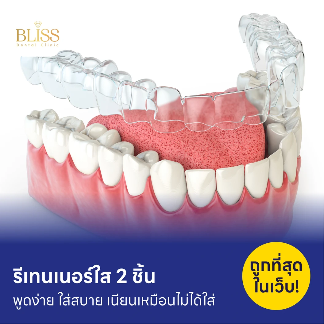 ทำรีเทนเนอร์แบบใส 2 ชิ้น แพ็กเกจ HDmall+ ที่ Bliss Dental Clinic