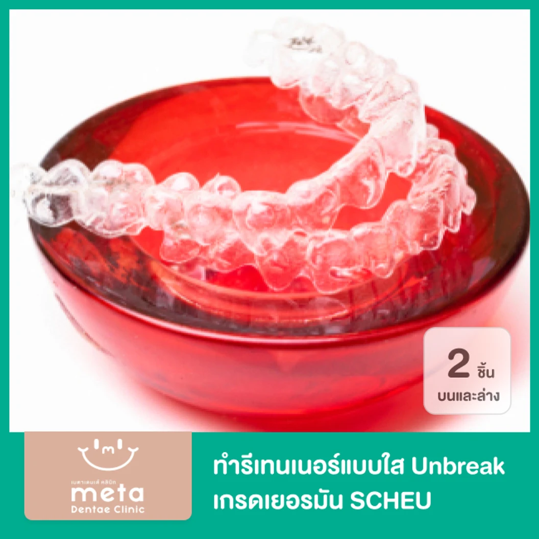 ทำรีเทนเนอร์ใสแบบ Unbreak เกรดเยอรมัน SCHEU 2 ชิ้น ฟันบนและล่าง ที่ Meta Dentae Clinic
