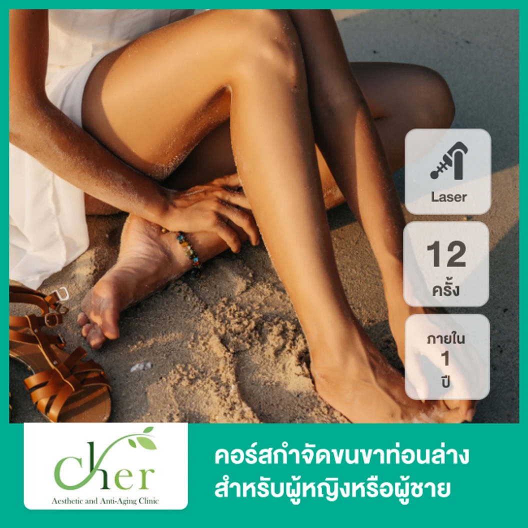 คอร์สกำจัดขนขาท่อนล่าง ด้วย Diode Laser 12 ครั้ง ภายใน 1 ปี สำหรับผู้หญิงเท่านั้น เฉพาะสาขาที่กำหนด สำหรับเคสทำครั้งแรก ที่ Cher Clinic