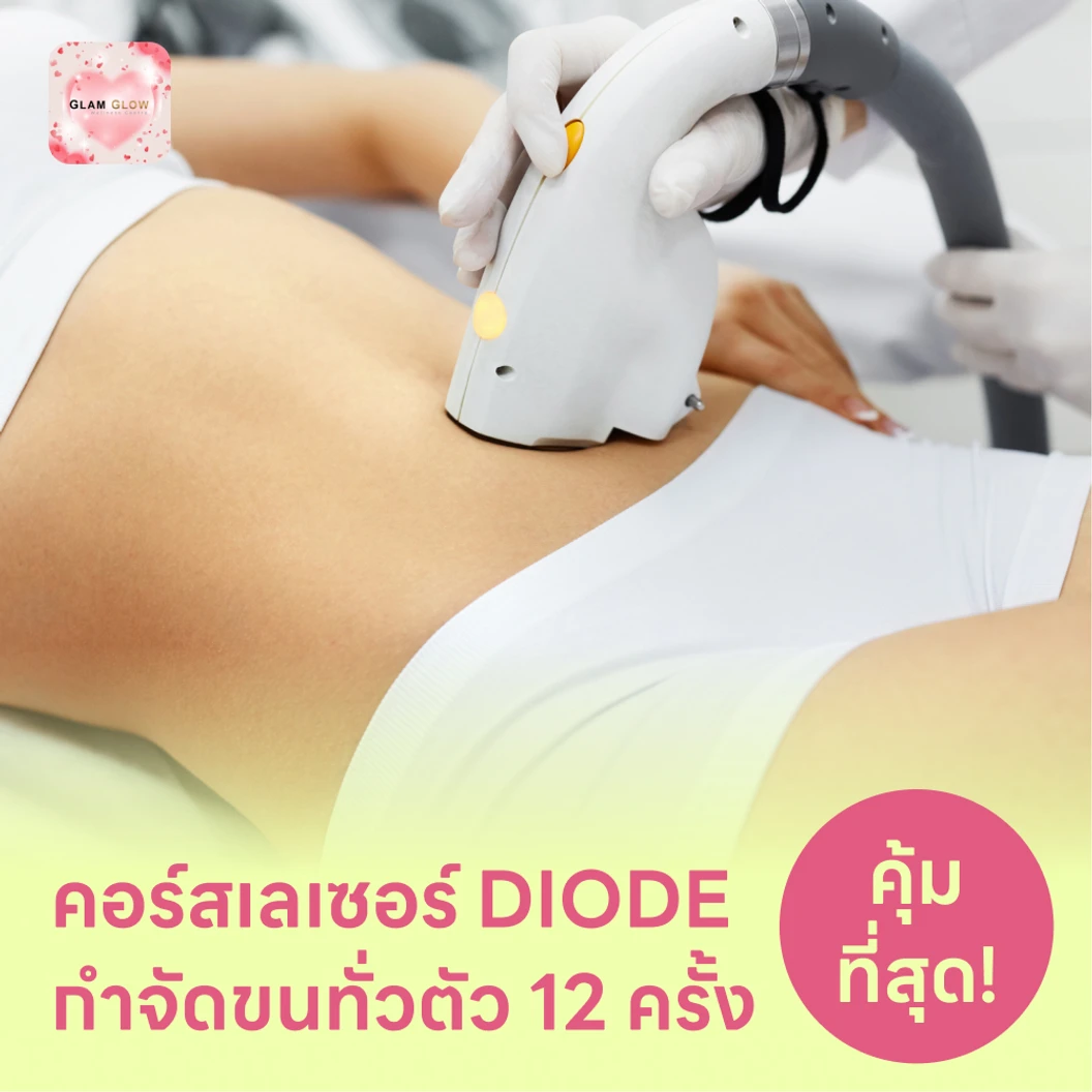 คอร์สเลเซอร์กำจัดขนทั่วร่างกาย 12 ครั้ง ด้วย Diode Laser แพ็กเกจ HDmall+ ที่ Glam Glow Wellness Centre