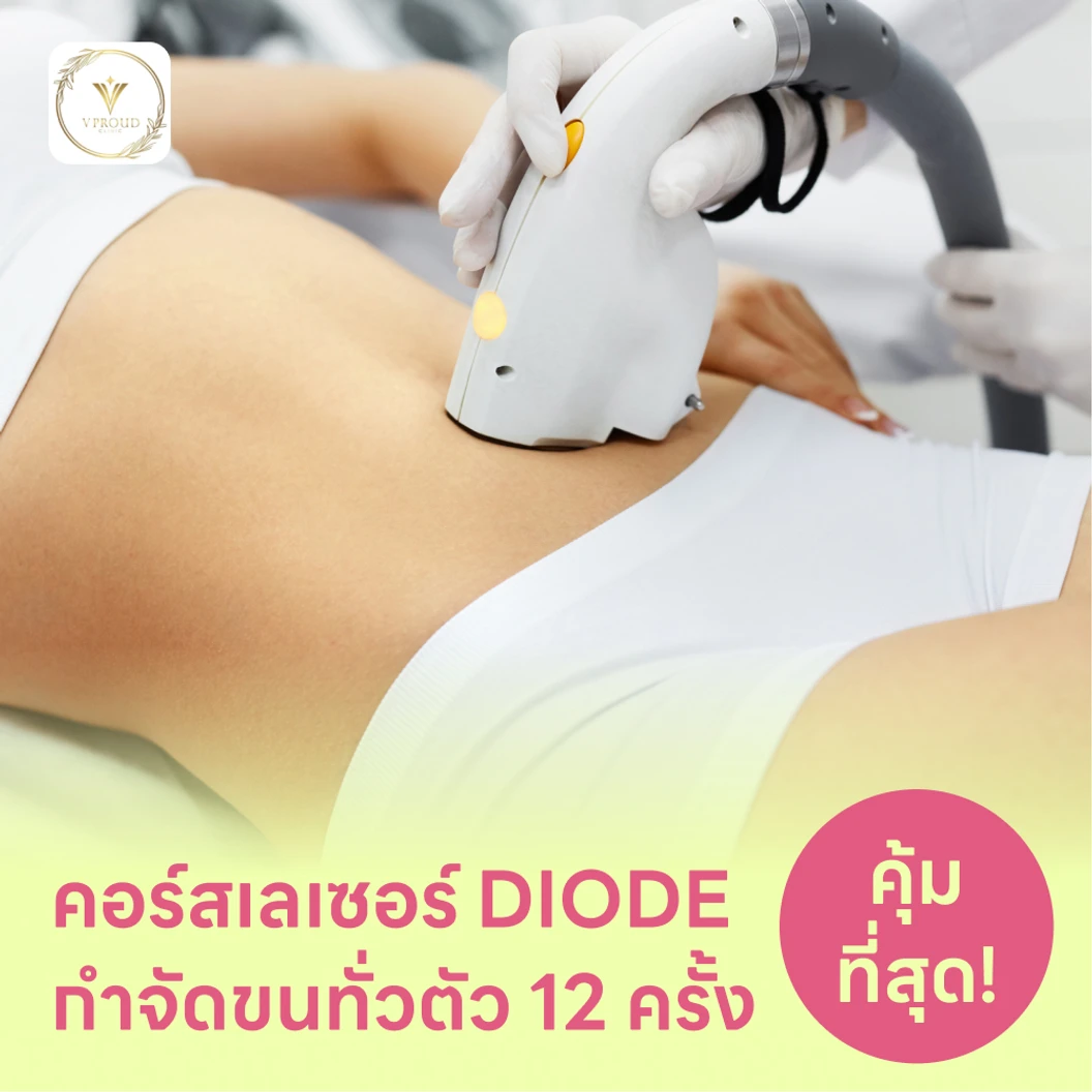 คอร์สเลเซอร์กำจัดขนทั่วร่างกาย 12 ครั้ง ด้วย Diode Laser แพ็กเกจ HDmall+ ที่ VProud Clinic
