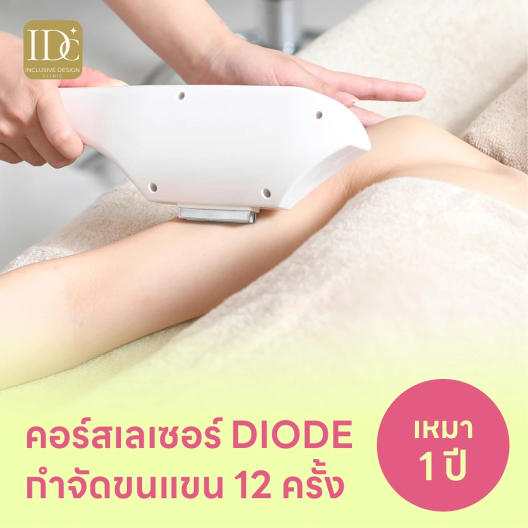 คอร์สเลเซอร์กำจัดขนทั่วแขน 12 ครั้ง ด้วย Diode Laser แพ็กเกจ HDmall+ ที่ IDC Clinic