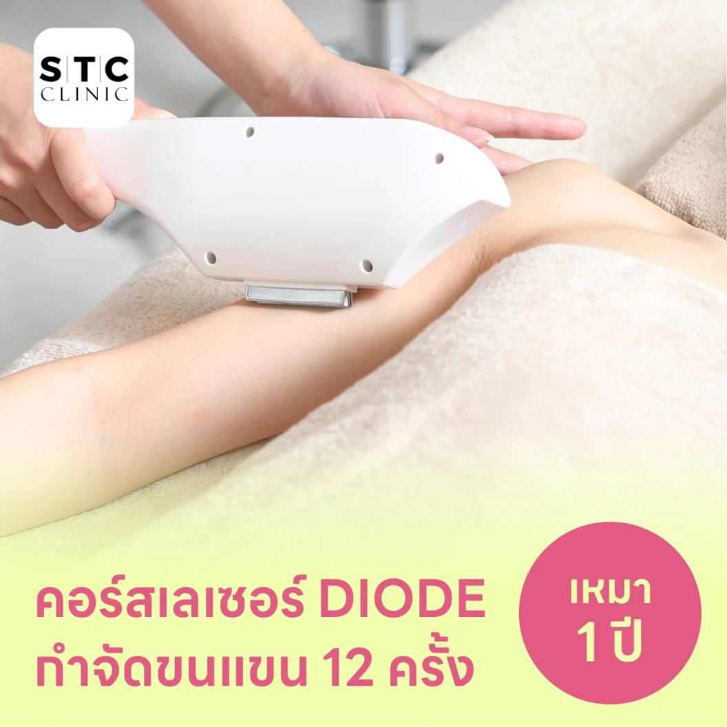 คอร์สเลเซอร์กำจัดขนทั่วแขน 12 ครั้ง ด้วย Diode Laser แพ็กเกจ HDmall+ ที่ STC Anti-Aging & Wellness Clinic