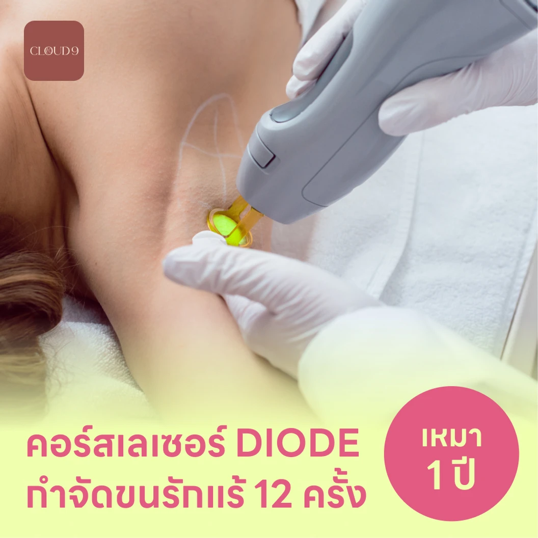 คอร์สเลเซอร์กำจัดขนรักแร้ 12 ครั้ง ด้วย Diode Laser แพ็กเกจ HDmall+ ที่ Cloud9 Clinic