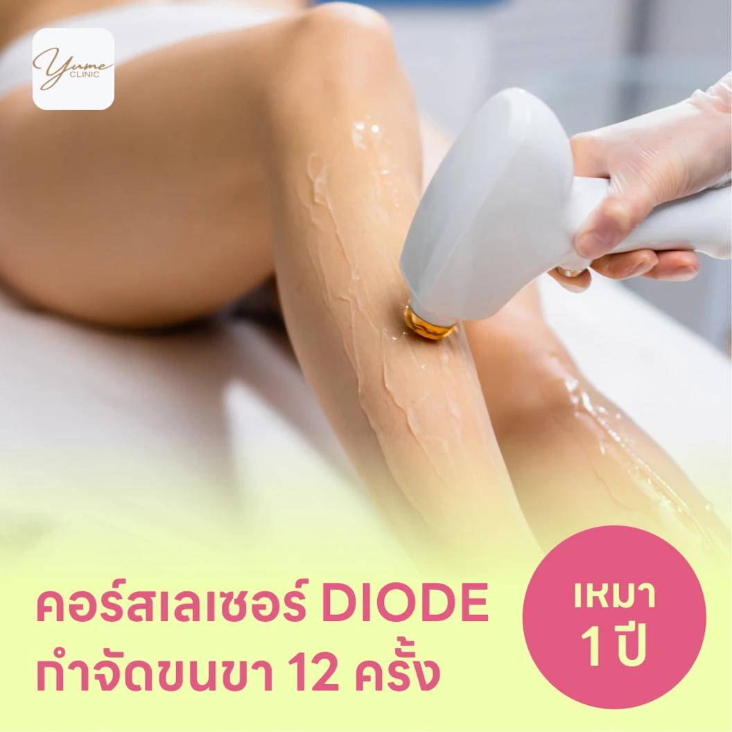 คอร์สเลเซอร์กำจัดขนทั่วขา 12 ครั้ง ด้วย Diode Laser แพ็กเกจ HDmall+ ที่ YUME clinic ยูเมะคลินิก
