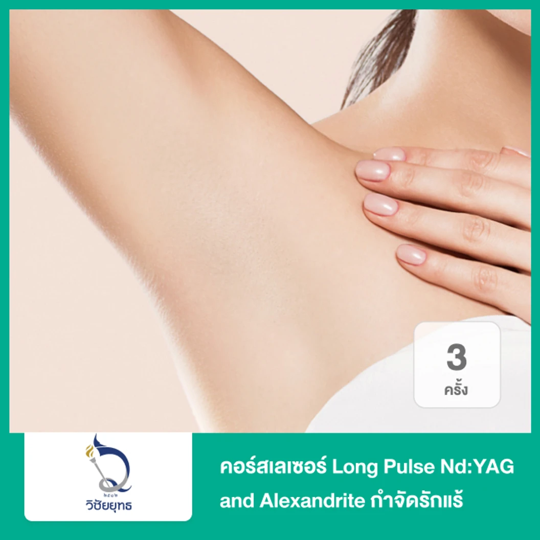 คอร์สเลเซอร์ Long Pulse NdYAG and Alexandrite กำจัดขนรักแร้ 3 ครั้ง ที่ โรงพยาบาลวิชัยยุทธ