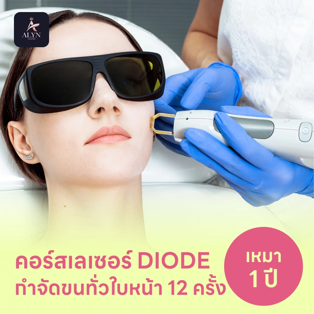คอร์สเลเซอร์กำจัดขนทั่วหน้า 12 ครั้ง ด้วย Diode Laser แพ็กเกจ HDmall+ ที่ ALYN Clinic
