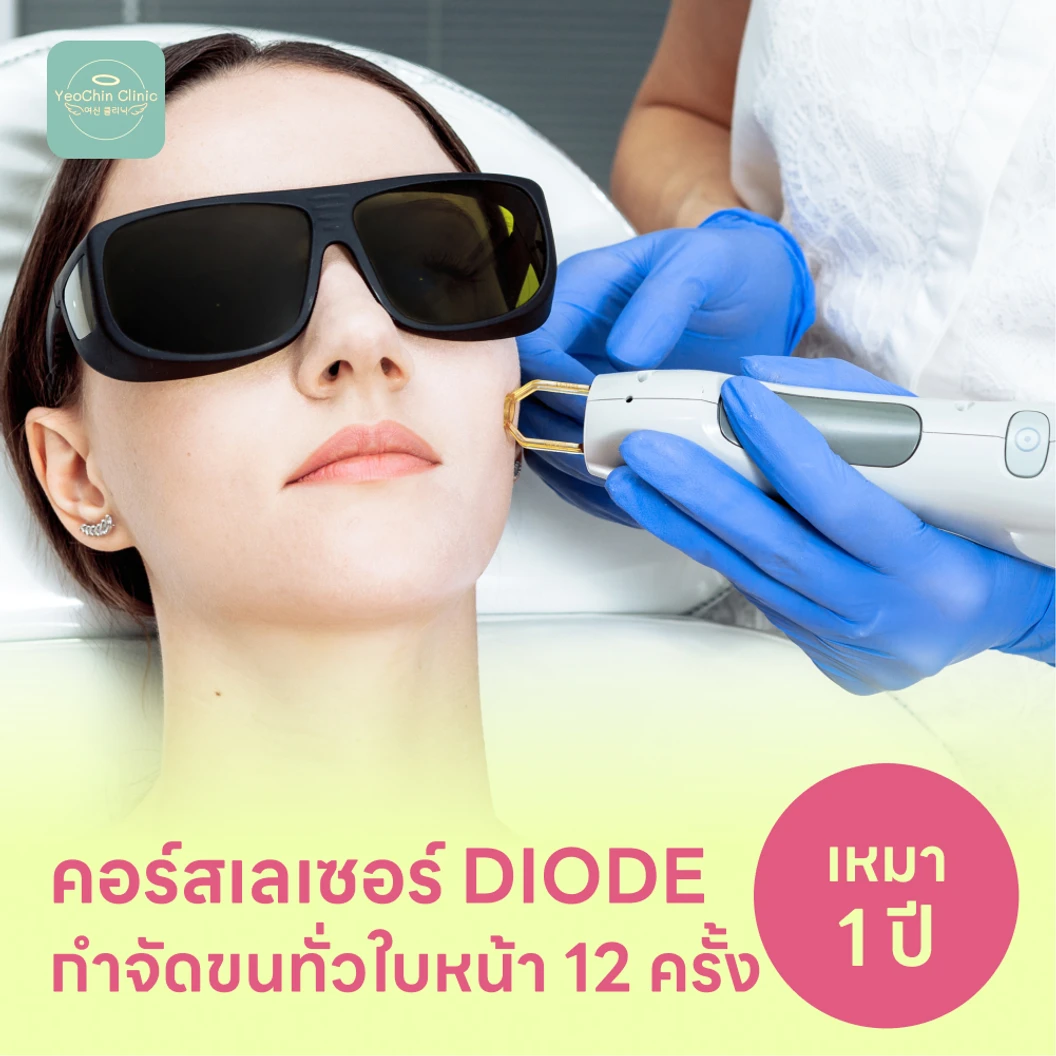 คอร์สเลเซอร์กำจัดขนทั่วหน้า 12 ครั้ง ด้วย Diode Laser แพ็กเกจ HDmall+ ที่ YeoChin Clinic ยอชินคลินิกเวชกรรม