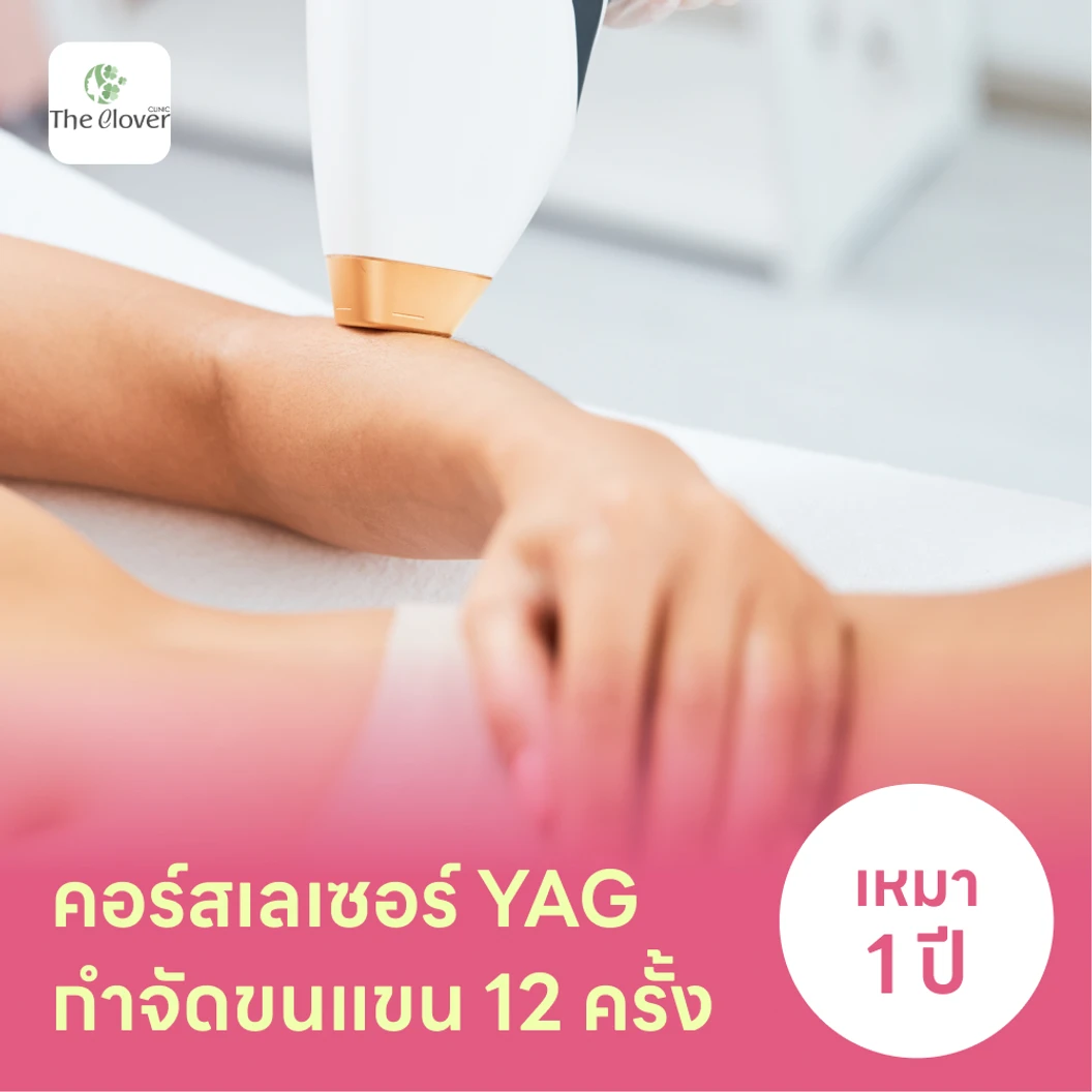 คอร์สเลเซอร์กำจัดขนแขน 12 ครั้ง ด้วย YAG Laser แพ็กเกจ HDmall+ ที่ The Clover Clinic