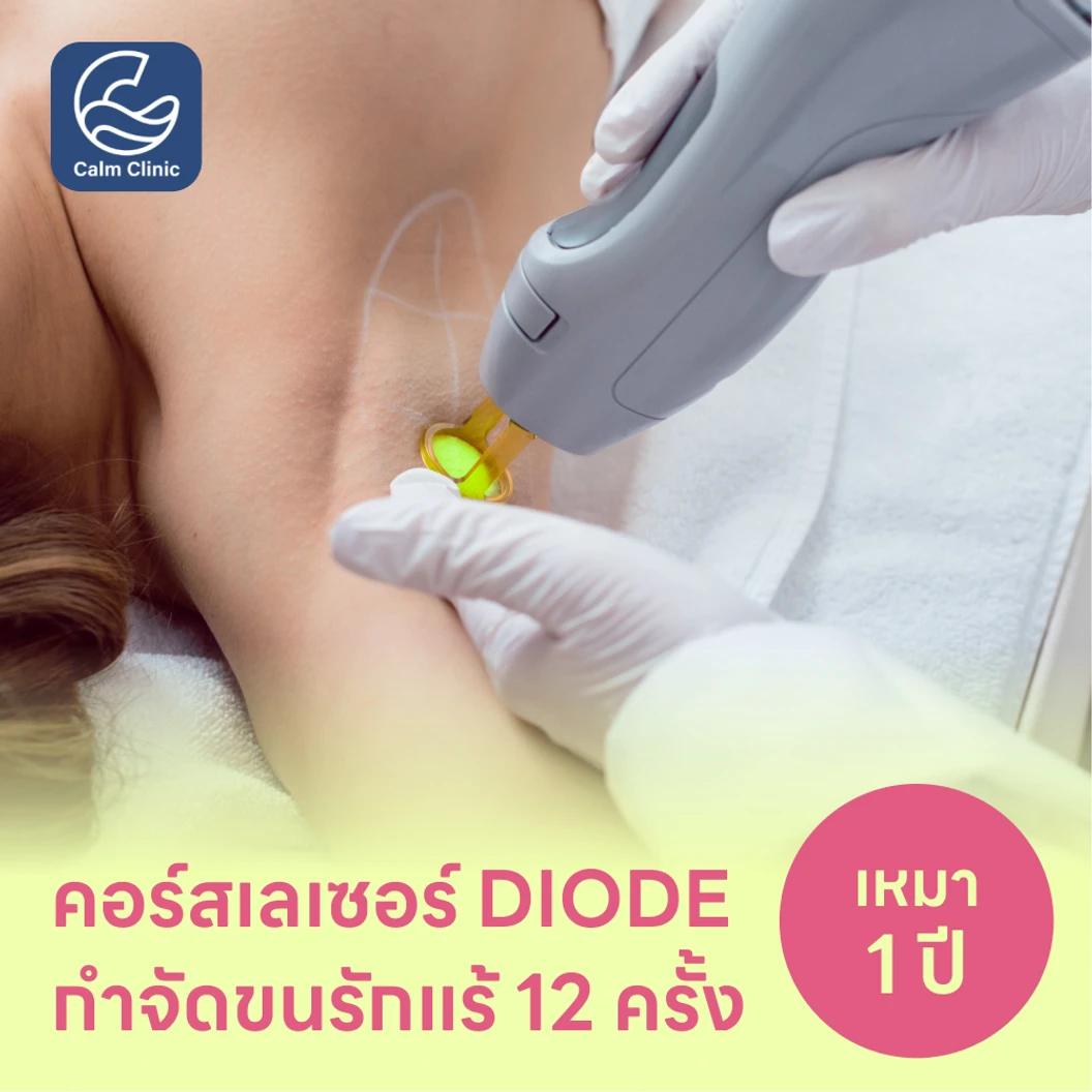 คอร์สเลเซอร์กำจัดขนรักแร้ 12 ครั้ง ด้วย Diode Laser แพ็กเกจ HDmall+ ที่ Calm Clinic