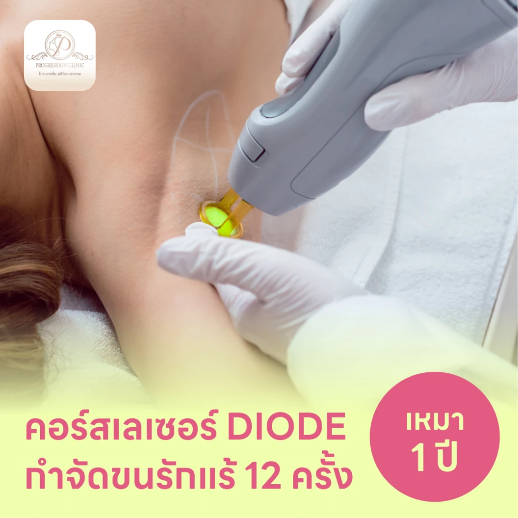 คอร์สเลเซอร์กำจัดขนรักแร้ 12 ครั้ง ด้วย Diode Laser แพ็กเกจ HDmall+ ที่ Progression Clinic